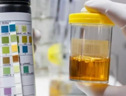 Jangan Anggap Sepele! 5 Warna Urine Ini Bisa Jadi Alarm Ginjal Bermasalah