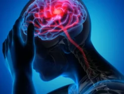 Bercak Kuning di Mata Bisa Jadi Tanda Risiko Stroke dan Serangan Jantung